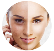 Anti Pigmentation Treatment