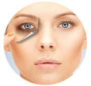 Dark Circle Treatment