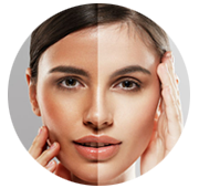 Face & Body Whitening Treatment