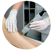 Laser Hair Removal